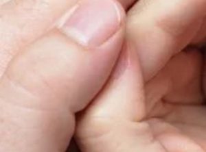 Mehr über den Artikel erfahren Hautstreichelei – Pflege für irritierte Haut